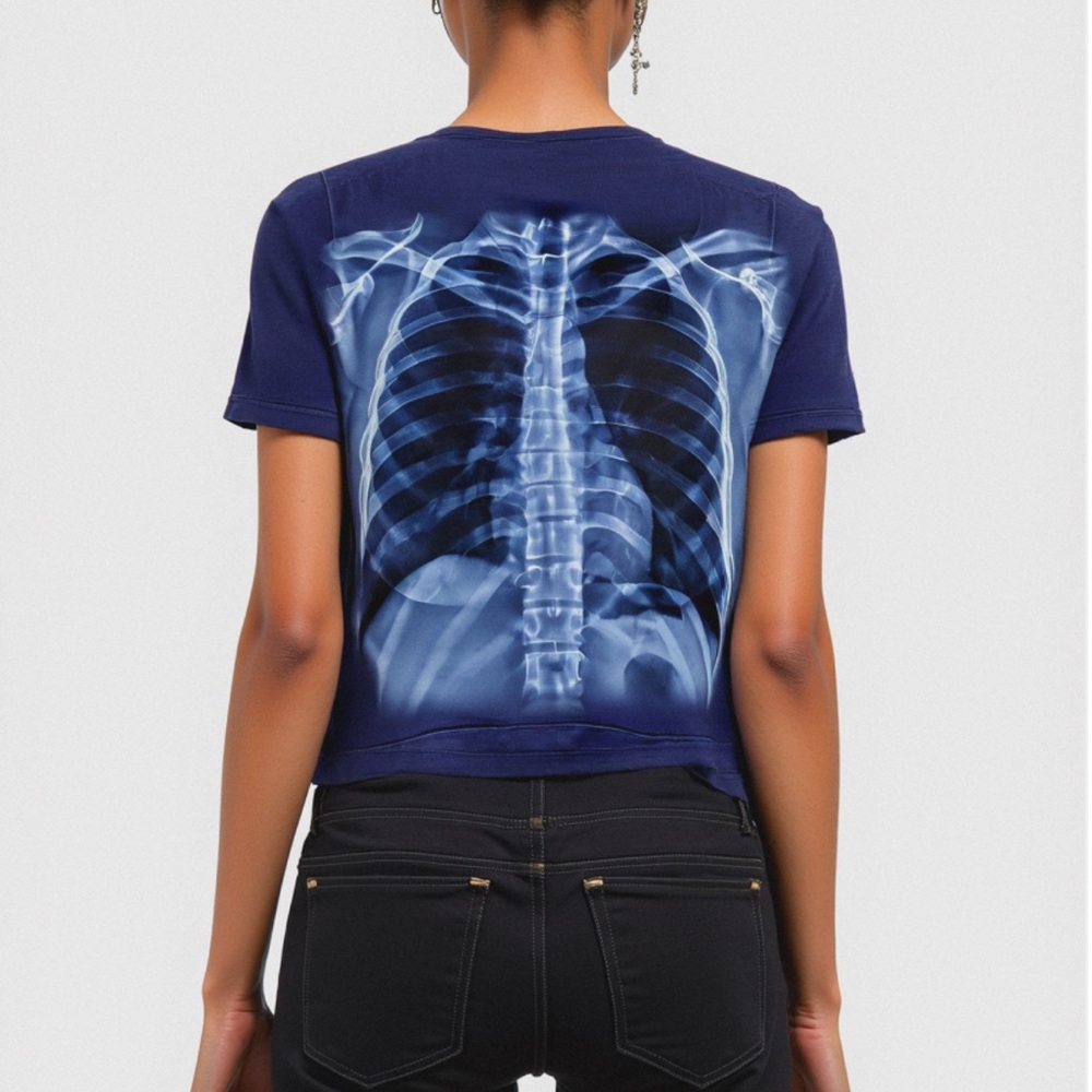 COPY - X-Ray Riches Tee